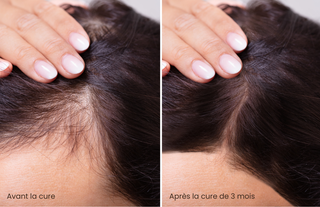 HairBoost+